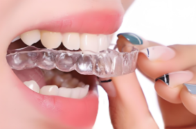 隱形矯正（隱適美、正雅、時代天使）